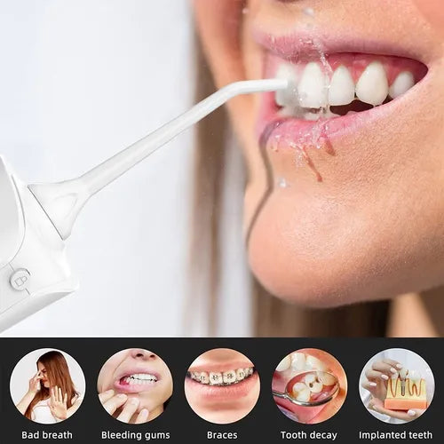 Irrigador Oral Limpieza Dental Portatil Inalambrico