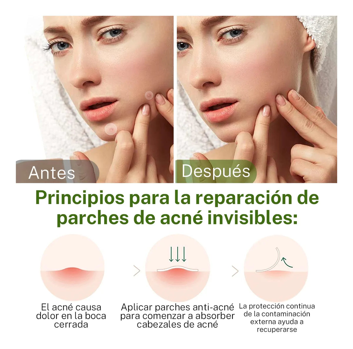 36 Parches Pegatinas Para Acné Absorbentes Transparente Normal Día/noche